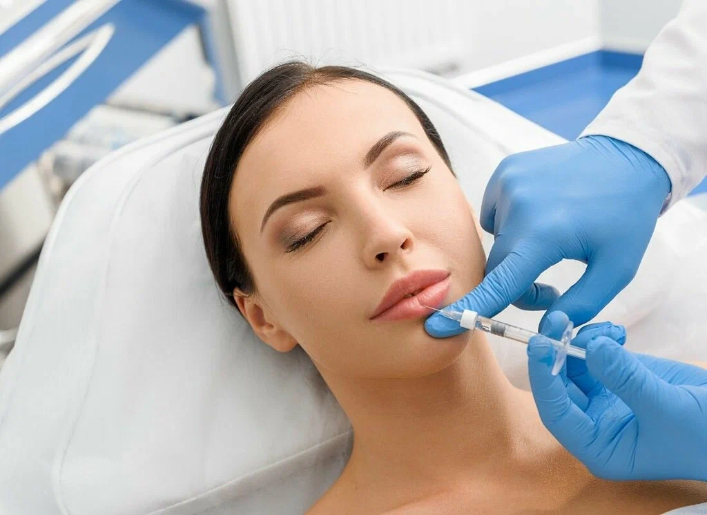 Our Lip Filler Treatment