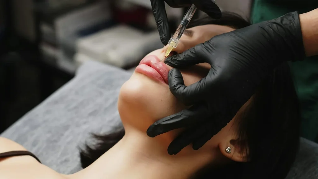Lip Fillers